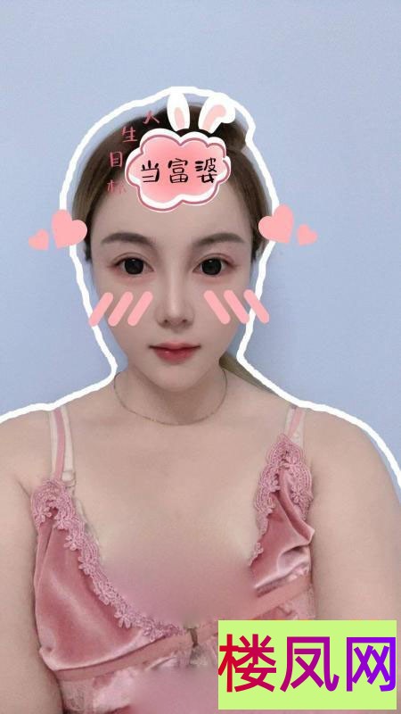 150501n2yq224gg4fx4p1h.jpg
